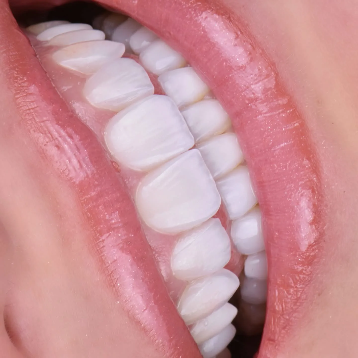 Armonía facial antes del diseño de sonrisa personalizado