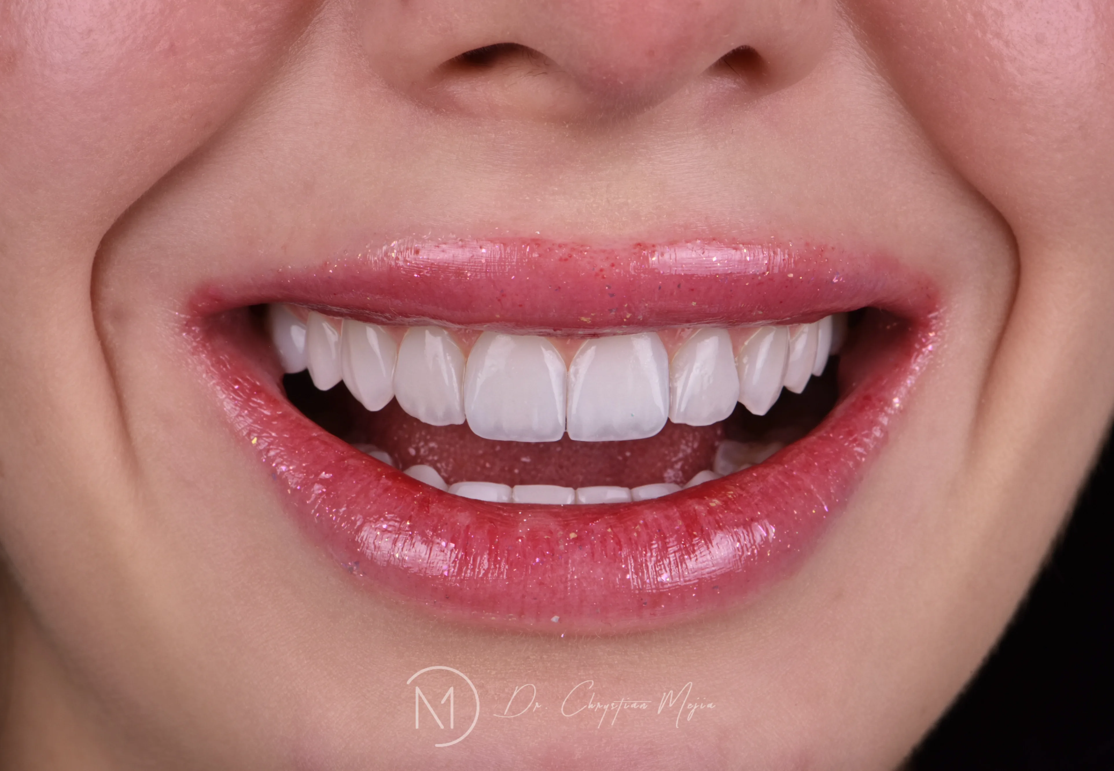 Interior moderno de la sucursal Smile Design Clinic en Guadalajara