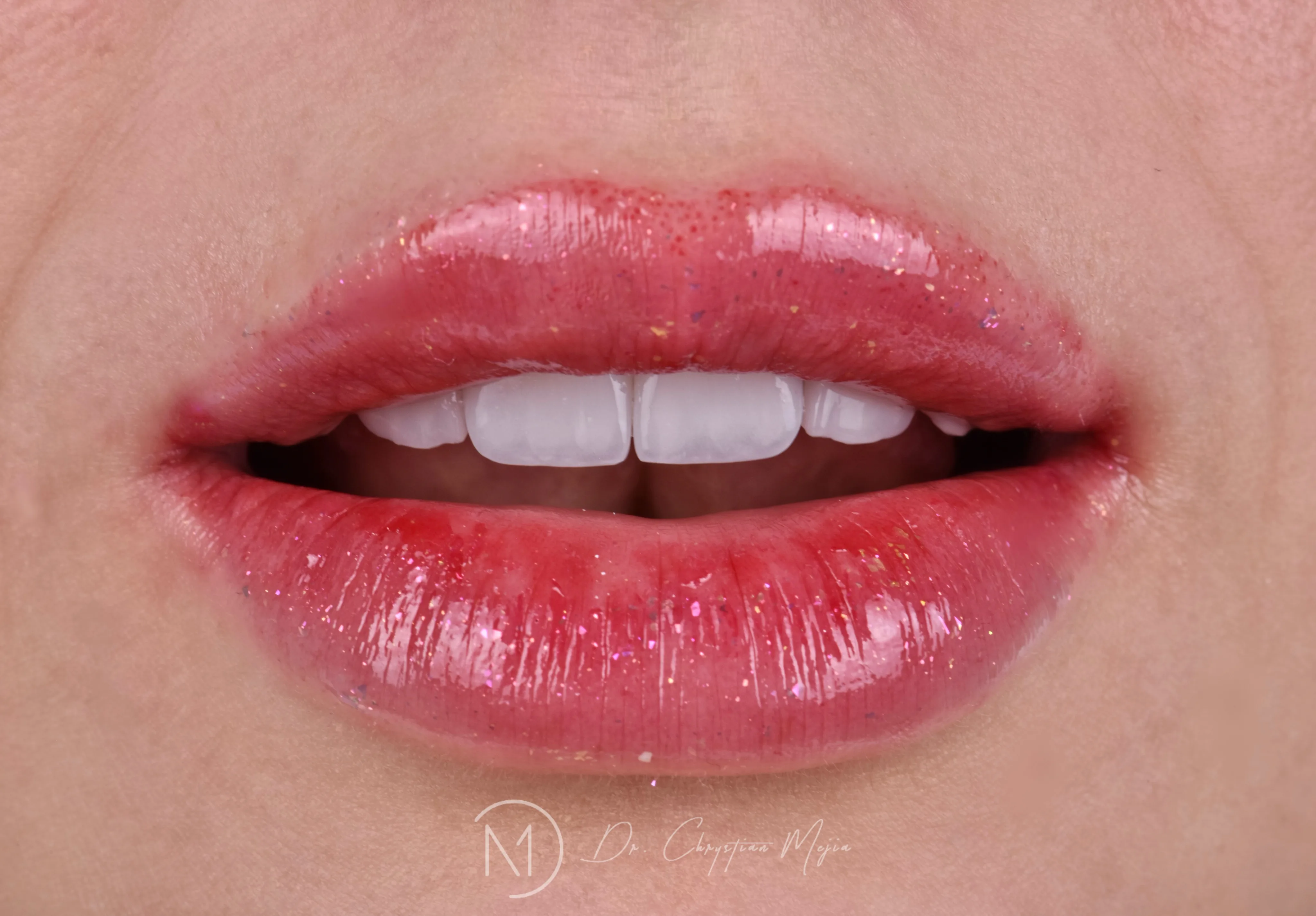 Visual artístico de diseño de sonrisa natural y carillas dentales premium en Smile Design Clinic